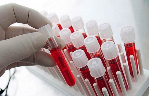 Профилактические анализы крови — зачем они нужны